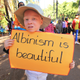Imagen para el artículo titulado Decapitan a una niña de cinco años por sus presuntas propiedades mágicas: el terror de ser albino en algunos países de África
